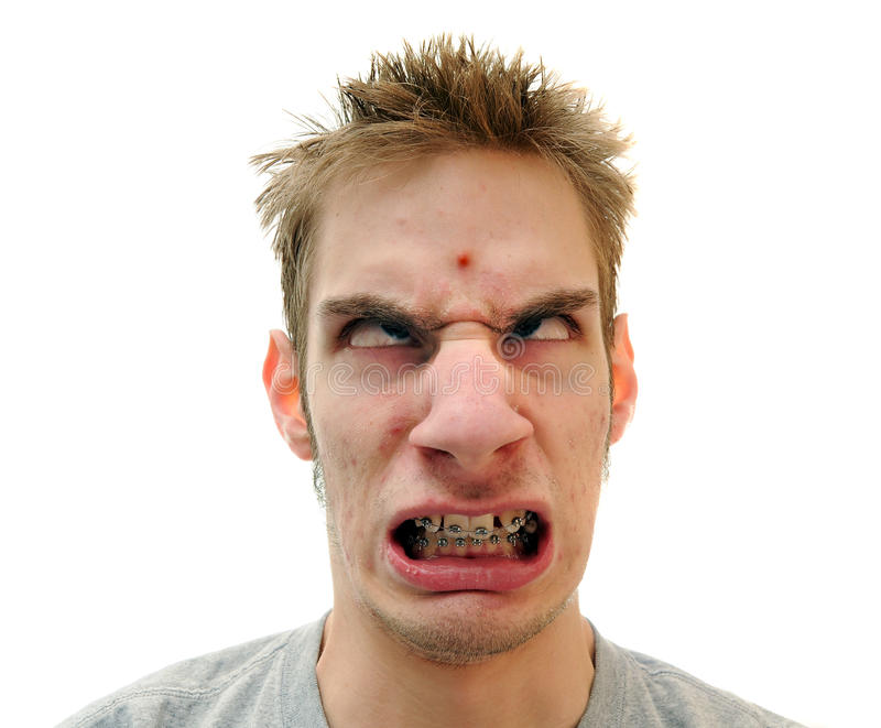 pimple-forehead-13000754